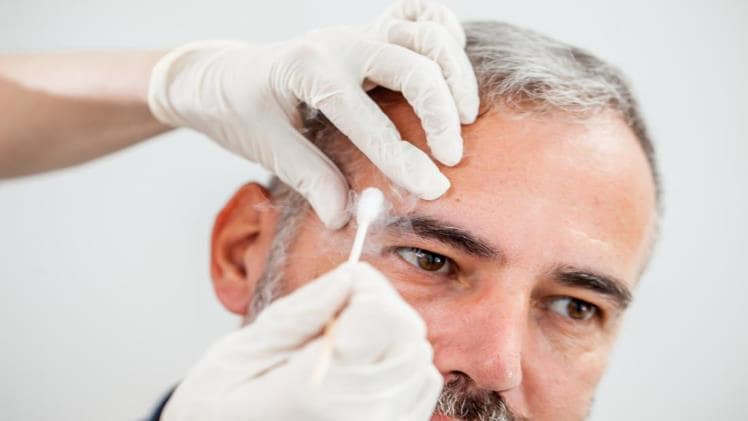 When to Worry About the Harmless Age Spots