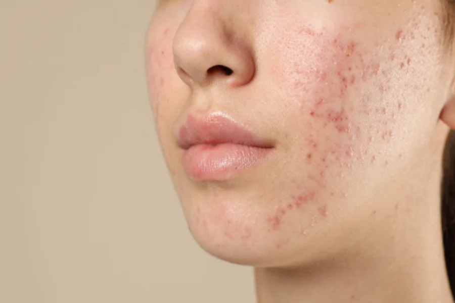 Persistent or Recurrent Skin Problems: When Specialist Assessment Becomes the Next Step?